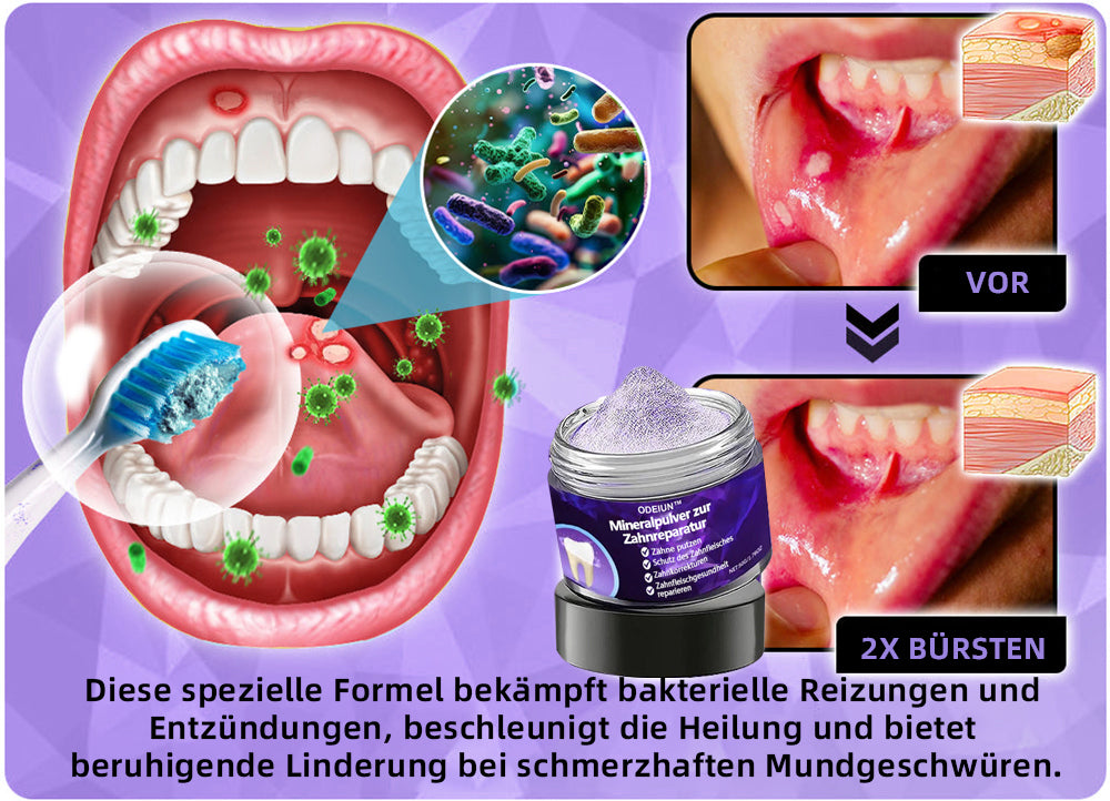 Blitzangebot 😍 – Nicht verpassen! – ODEIUN™ Mineralpulver zur Zahnreparatur 🦷 (von der BZÄK empfohlen) 👩⚕️