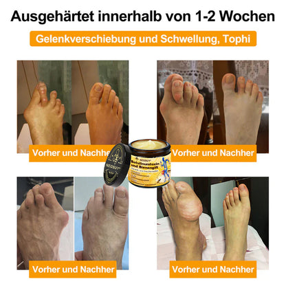 ✅ Offizieller Shop: Negusy® Bienengift-Schmerzlinderungs Knochenheilungs Creme 👨‍⚕️(Reduzierung von Gelenkschwellungen, Schmerzen, Steifheit, Rötungen, Wärme, Muskelkater und Gelenkmüdigkeit)