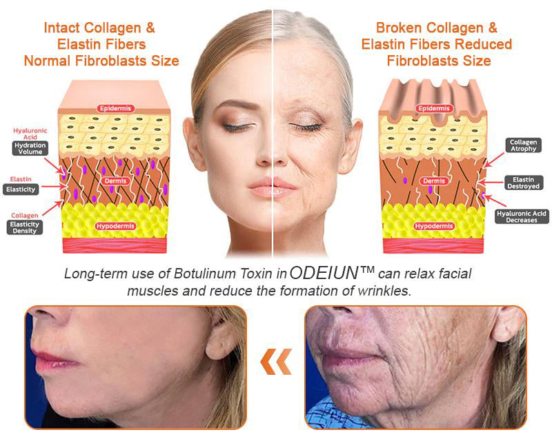 In Deutschland hergestellt und versendet ✨ ODEIUN™ Bienengift-Komplexcreme 🔥 LETZTER TAG: 80 % RABATT 💎💎