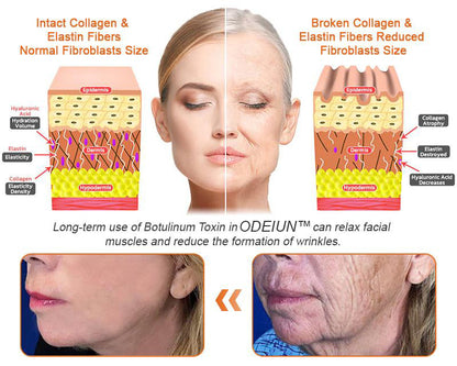 In Deutschland hergestellt und versendet ✨ ODEIUN™ Bienengift-Komplexcreme 🔥 LETZTER TAG: 80 % RABATT 💎💎