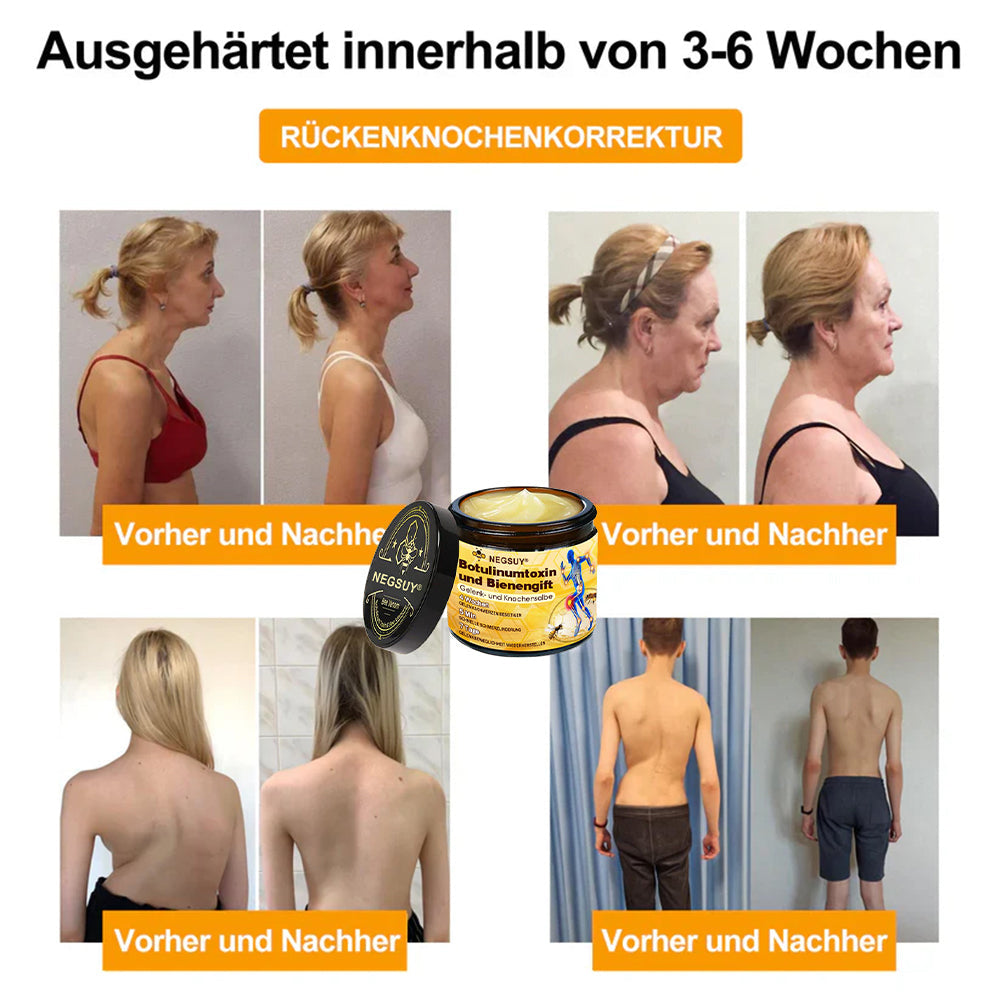 ✅ Offizieller Shop: Negusy® Bienengift-Schmerzlinderungs Knochenheilungs Creme 👨‍⚕️(Reduzierung von Gelenkschwellungen, Schmerzen, Steifheit, Rötungen, Wärme, Muskelkater und Gelenkmüdigkeit)