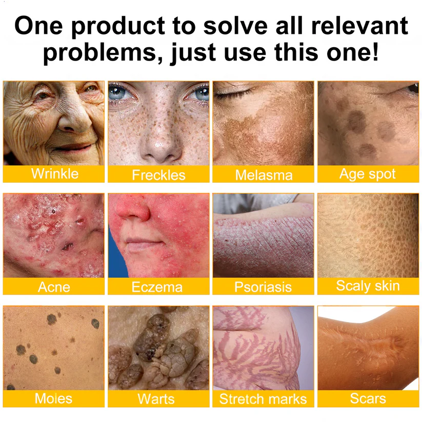 🔥ODALIT® Bienengift Pro Umfassende Creme — 🔥Begrenzte Zeit 80 % RABATT🔥