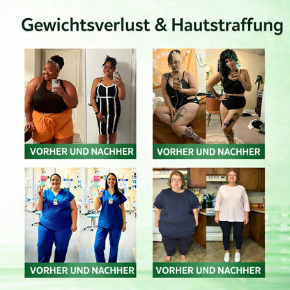 Offizieller Shop 🇩🇪 | LBMLBM™ Moringa-Berberin × NAD+ 10-in-1 Nano-Mikronadel-Pflaster – Tägliche, sichtbare Ergebnisse in 7 Tagen ✅ Für Gewichtskontrolle, Hautgesundheit, Diabetes und Gelenkgesundheit