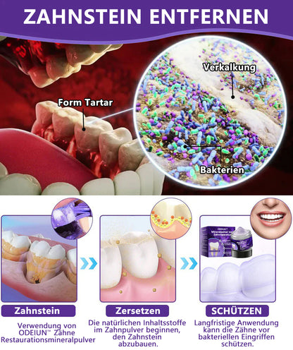 Blitzangebot 😍 – Nicht verpassen! – ODEIUN™ Mineralpulver zur Zahnreparatur 🦷 (von der BZÄK empfohlen) 👩‍⚕️