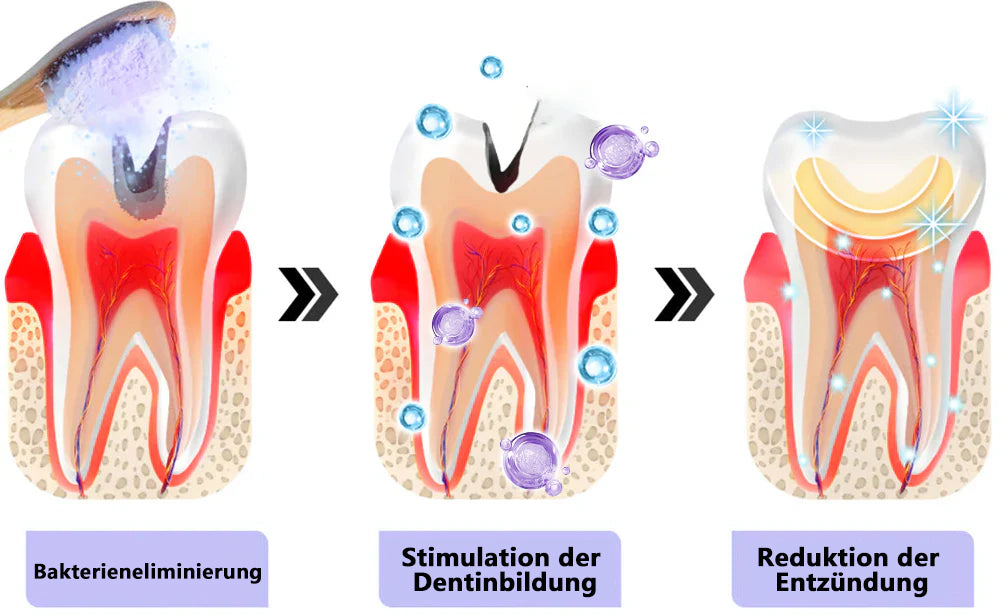 Blitzangebot 😍 – Nicht verpassen! – ODEIUN™ Mineralpulver zur Zahnreparatur 🦷 (von der BZÄK empfohlen) 👩‍⚕️