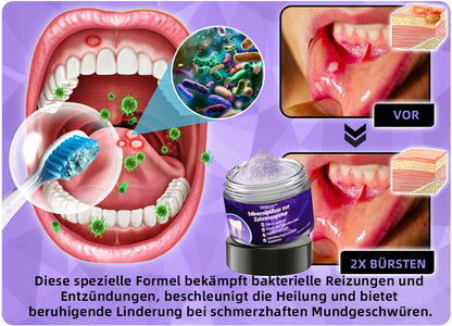 Blitzangebot 😍 – Nicht verpassen! – ODEIUN™ Mineralpulver zur Zahnreparatur 🦷 (von der BZÄK empfohlen) 👩‍⚕️