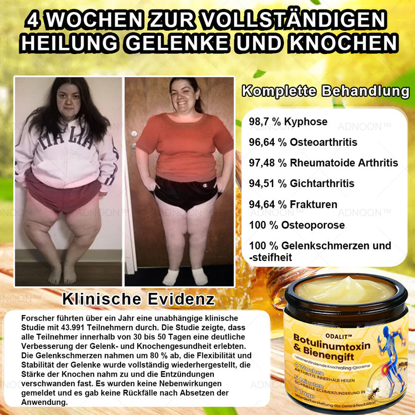 🎁Blitzangebot - ODALIT™ Botulinumtoxin & Bienengift Schmerzlindernde Knochenheilcreme🐝💎