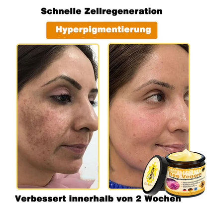 🔥ODALIT® Bienengift Pro Umfassende Creme — 🔥Begrenzte Zeit 80 % RABATT🔥
