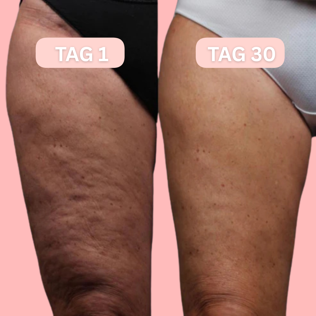 Cellufit - Massageroller