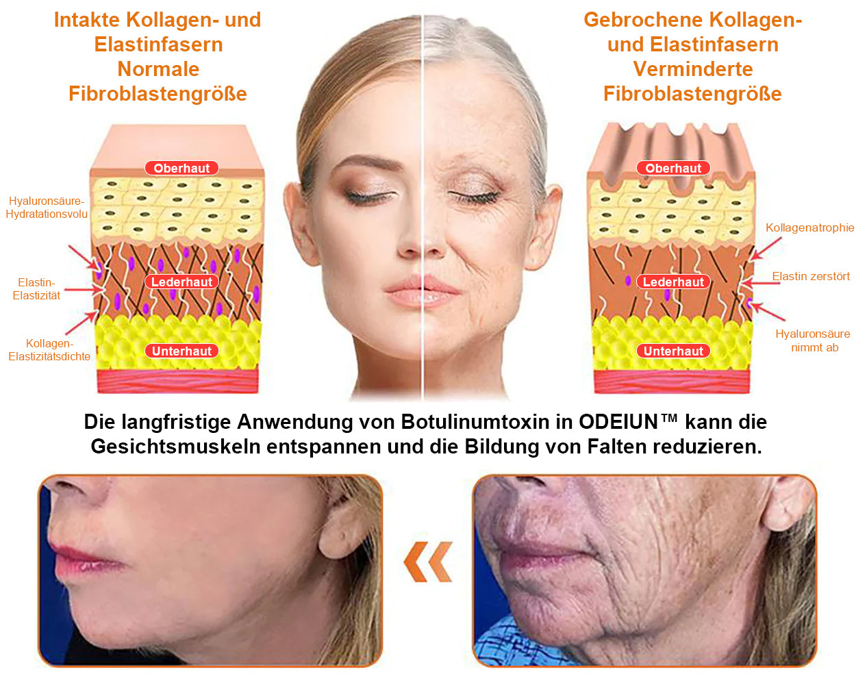 In Deutschland hergestellt und versendet ✨ ODEIUN™ Bienengift-Komplexcreme 🔥 LETZTER TAG: 80 % RABATT