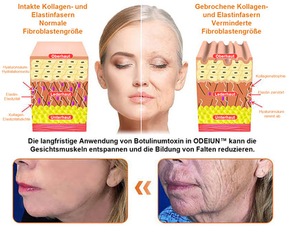 In Deutschland hergestellt und versendet ✨ ODEIUN™ Bienengift-Komplexcreme 🔥 LETZTER TAG: 80 % RABATT