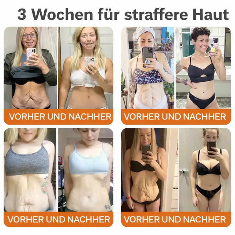 💝 ODALIT™ Botox Bienenvenom Straffender Serum-Stick | Hergestellt in Deutschland🔥