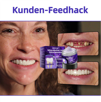 Blitzangebot 😍 – Nicht verpassen! – ODEIUN™ Mineralpulver zur Zahnreparatur 🦷 (von der BZÄK empfohlen) 👩‍⚕️