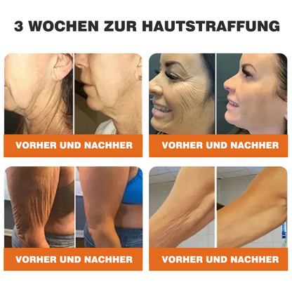 🔥ODALIT® Bienengift Pro Umfassende Creme — 🔥Begrenzte Zeit 80 % RABATT🔥