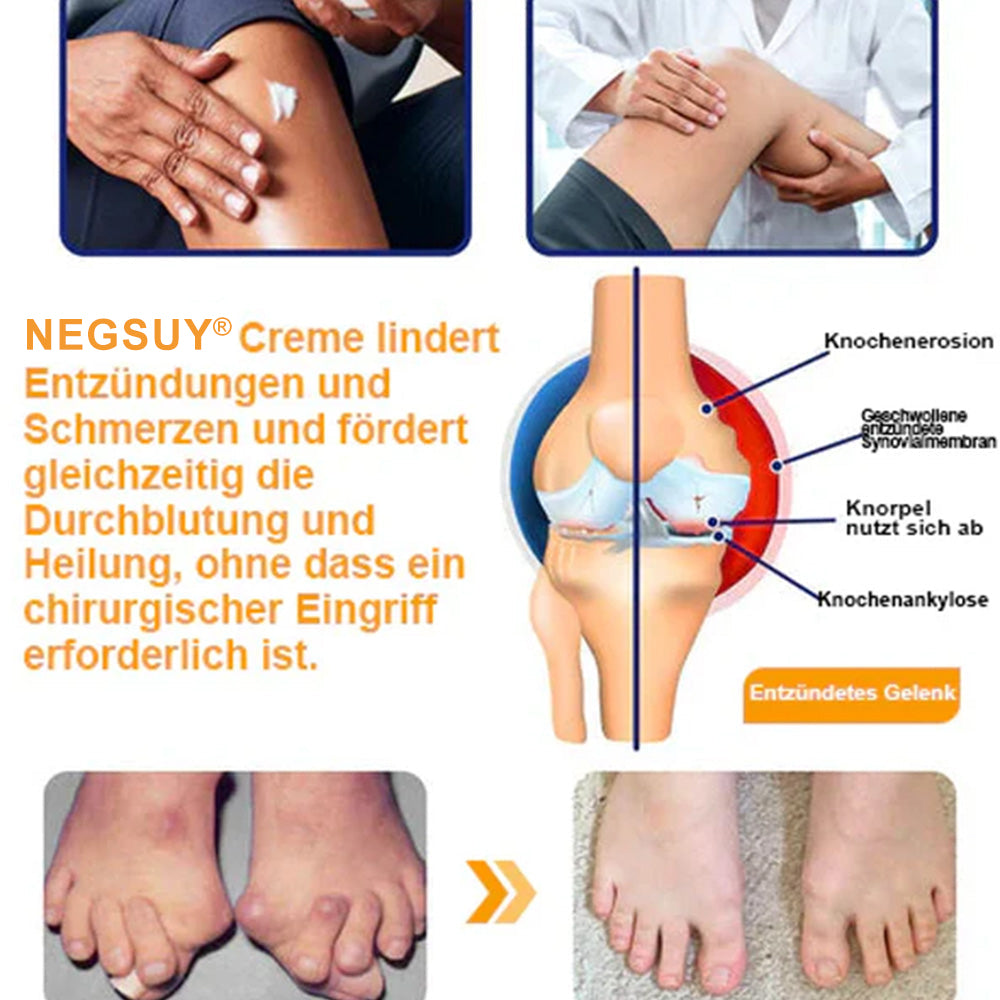 ✅ Offizieller Shop: Negusy® Bienengift-Schmerzlinderungs Knochenheilungs Creme 👨‍⚕️(Reduzierung von Gelenkschwellungen, Schmerzen, Steifheit, Rötungen, Wärme, Muskelkater und Gelenkmüdigkeit)
