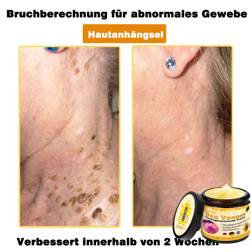 🔥ODALIT® Bienengift Pro Umfassende Creme — 🔥Begrenzte Zeit 80 % RABATT🔥