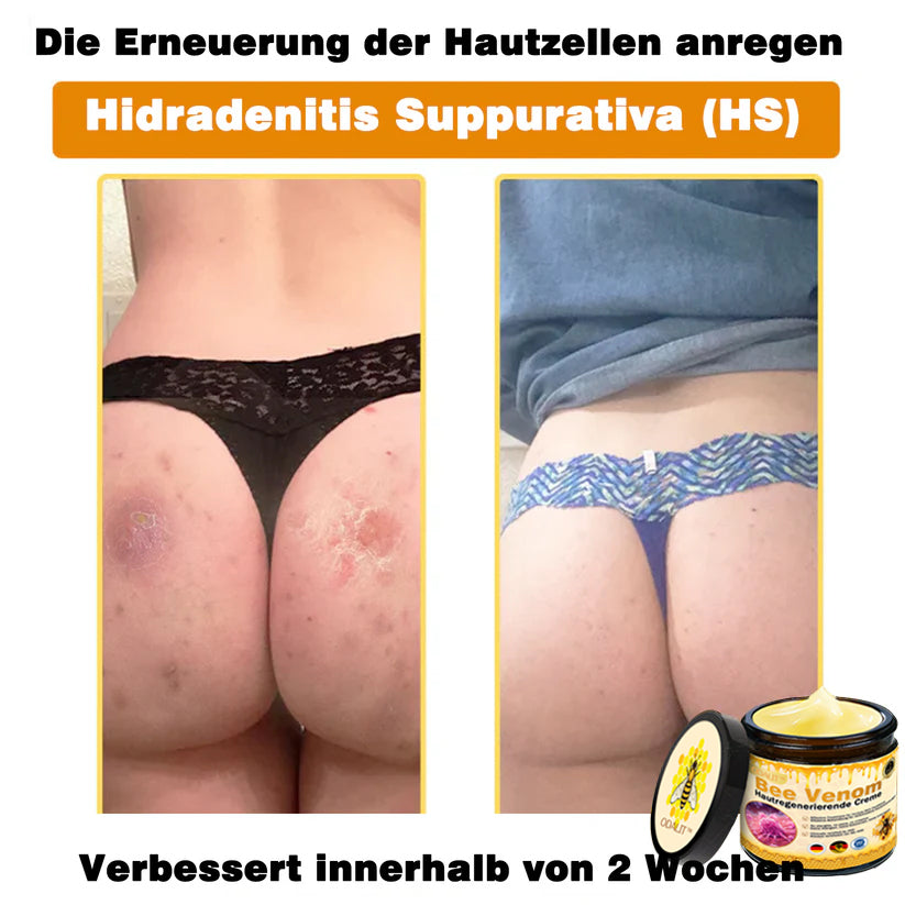 🔥ODALIT® Bienengift Pro Umfassende Creme — 🔥Begrenzte Zeit 80 % RABATT🔥