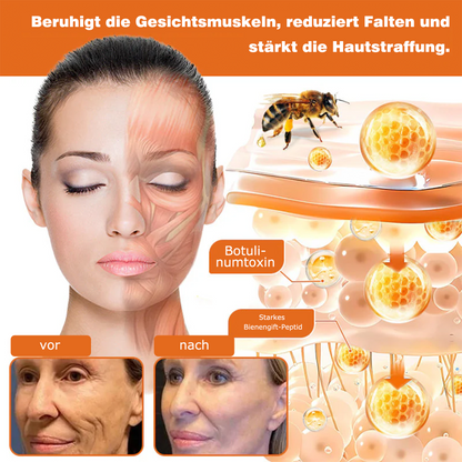 🔥ODALIT® Bienengift Pro Umfassende Creme — 🔥Begrenzte Zeit 80 % RABATT🔥