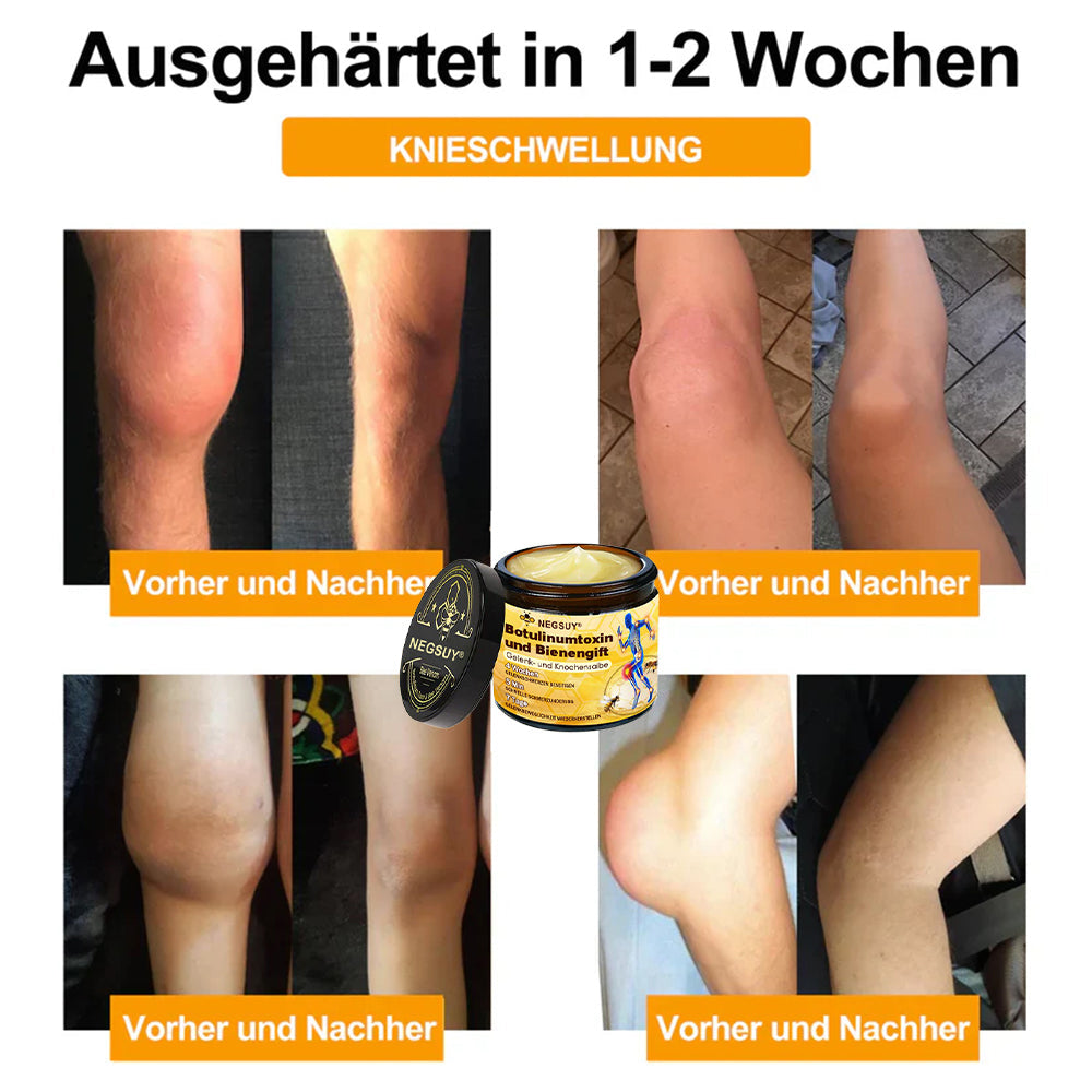 ✅ Offizieller Shop: Negusy® Bienengift-Schmerzlinderungs Knochenheilungs Creme 👨‍⚕️(Reduzierung von Gelenkschwellungen, Schmerzen, Steifheit, Rötungen, Wärme, Muskelkater und Gelenkmüdigkeit)
