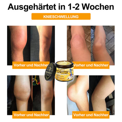 ✅ Offizieller Shop: Negusy® Bienengift-Schmerzlinderungs Knochenheilungs Creme 👨‍⚕️(Reduzierung von Gelenkschwellungen, Schmerzen, Steifheit, Rötungen, Wärme, Muskelkater und Gelenkmüdigkeit)
