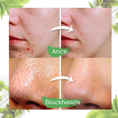 Seurico™ Grüner-Tee-Tonerde-Maskenstick zur Ölregulierung, Reduzierung von Mitessern und Verfeinerung der Poren