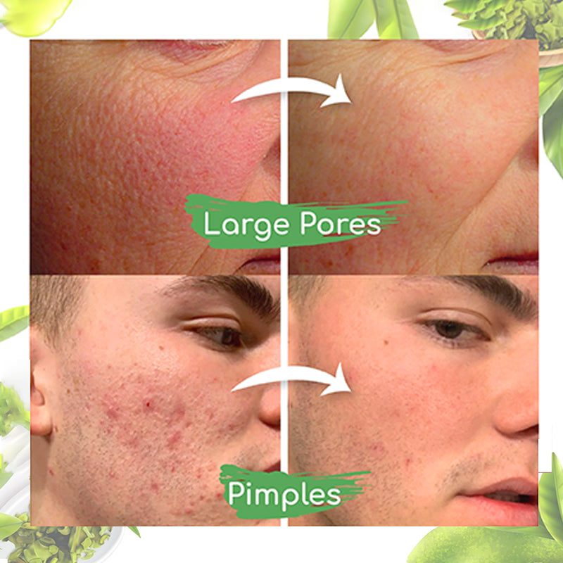 Seurico™ Grüner-Tee-Tonerde-Maskenstick zur Ölregulierung, Reduzierung von Mitessern und Verfeinerung der Poren