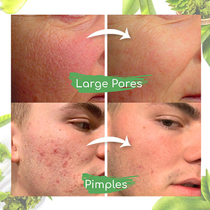 Seurico™ Grüner-Tee-Tonerde-Maskenstick zur Ölregulierung, Reduzierung von Mitessern und Verfeinerung der Poren