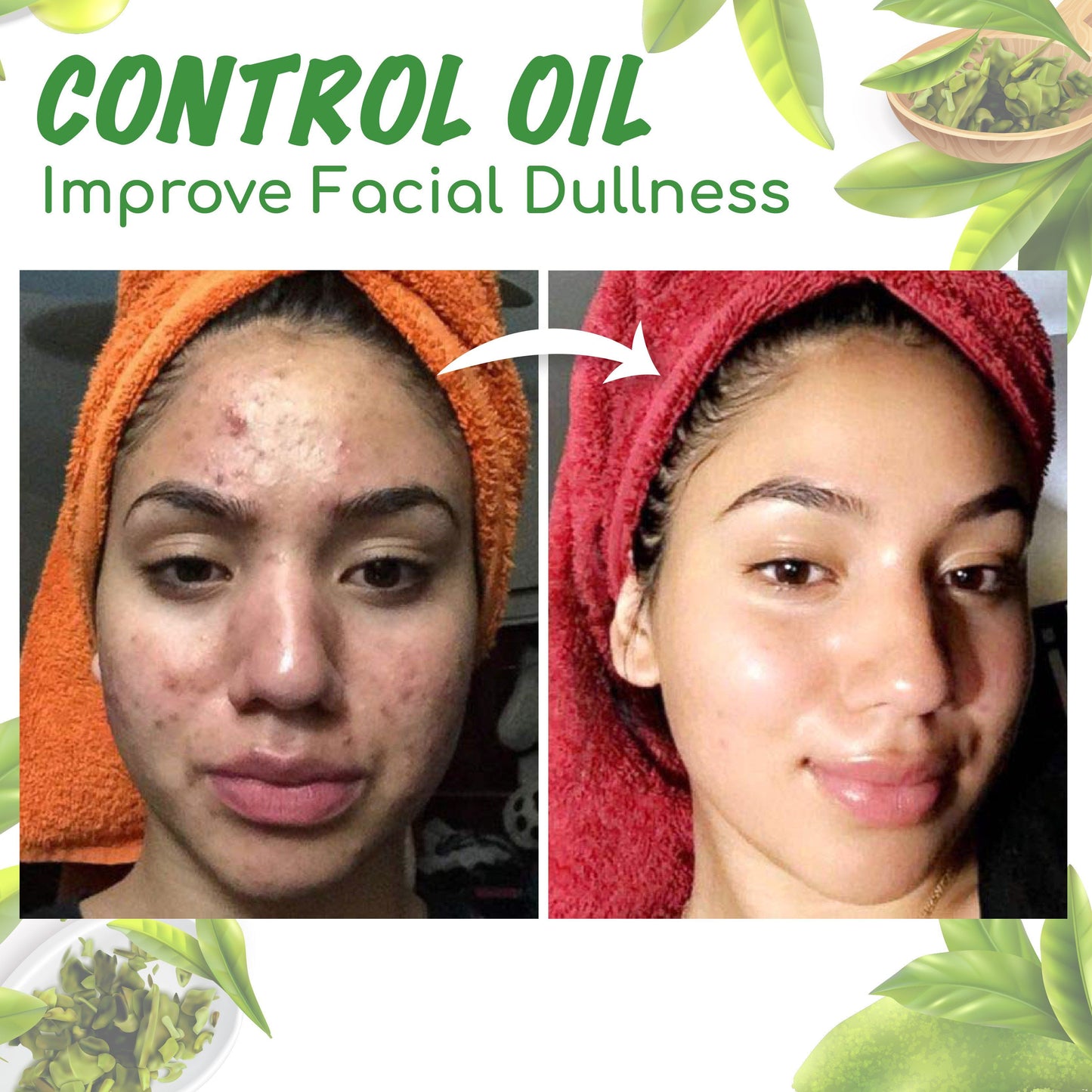 Seurico™ Grüner-Tee-Tonerde-Maskenstick zur Ölregulierung, Reduzierung von Mitessern und Verfeinerung der Poren